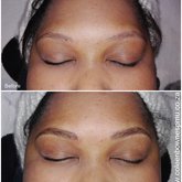 Microblade hairstroke eyebrows. Remember its a 2 step process and will need a refinement session 6 weeks after the first.
