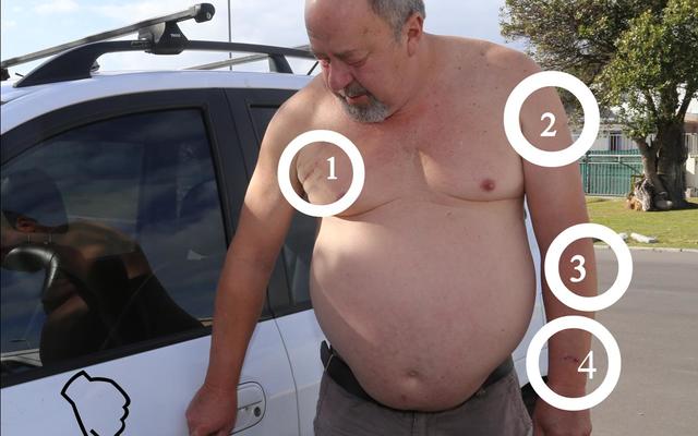 Jakkals Scholtz is kort na sy 60ste verjaardag 5 keer met ‘n mes gesteek nadat hy met ‘n slenter van die N2 afgedwing is.  Hy was oppad na Kaapstad Lughawe om sy vrou te gaan haal.  Hier wys hy na ‘n bloedstreep teen sy motor wat agter gelaat is deur sy aanvaller. Hy vermoed die rower is deur die glasstukke van sy motor se stukkende passasiersruit gesny toe hy weggejaag het. 