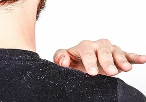 What really works on dandruff?