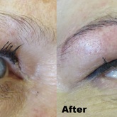 Microblading Before & After