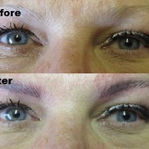 Microblading Before & After