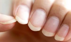 Vier stappe vir gesonder naels