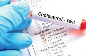 What Is High Cholesterol?