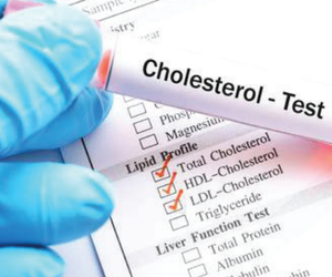 What Is High Cholesterol?