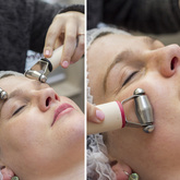 Hermanus - Overberg Skin & Body Clinic - Rollers