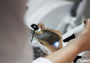 Black Diamond Laser Treatment