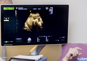 Coronavirus & Pregnancy