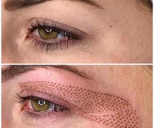 Plasma Pen Coming Soon!