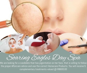 Candidate Needed For Pigmentation Removal Treatment