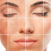 Natural remedies for the skin