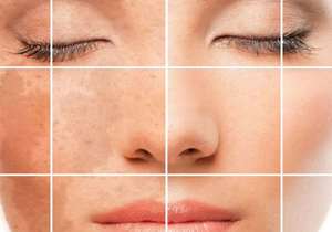 Natural remedies for the skin