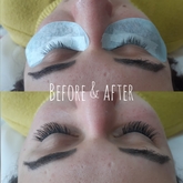 Before & After Treatment - Second Skin Beauty Salon - Xplorio™ Bredasdorp