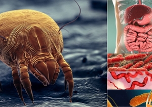 4 Disgusting Facts About Your Carpet