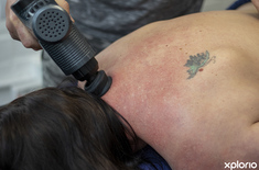 gansbaai_fitness_and_wellbeing_sprots_theraphy_gansbaai_muscle_straining_1660214396